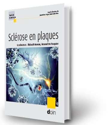 Image de Sclérose en plaques