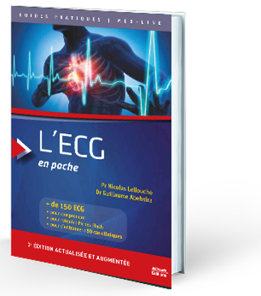 Image de L'ECG en poche